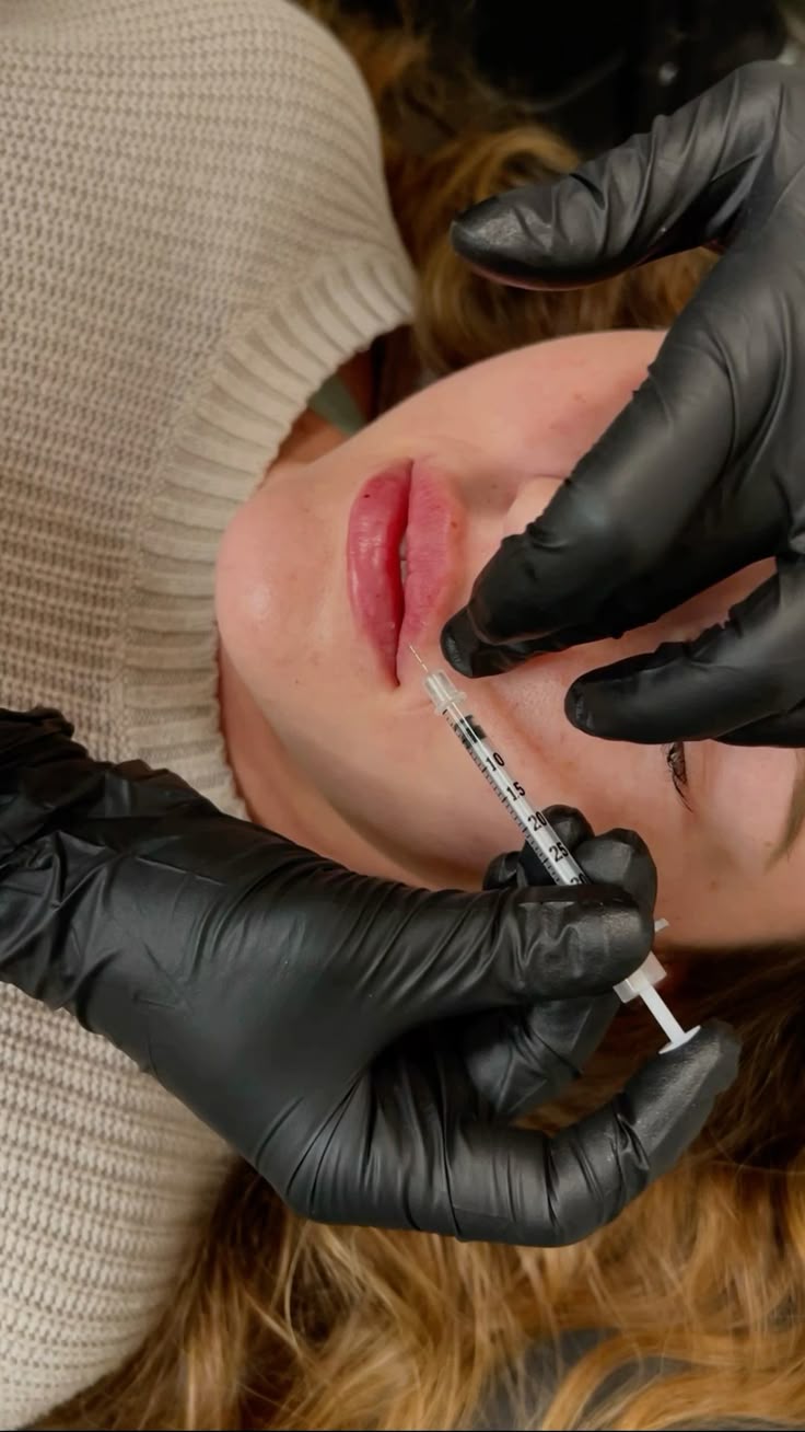 Αυξητική Χειλιών